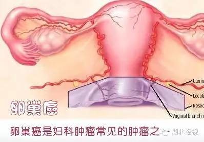 震惊!这类爽身粉竟然致癌! 强生被判赔4.7亿 !大