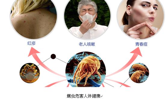 彻底干掉你被子上几百万的螨虫,只要一个妙招! 彻底干掉你被子上几百万的螨虫,只要一个妙招!
