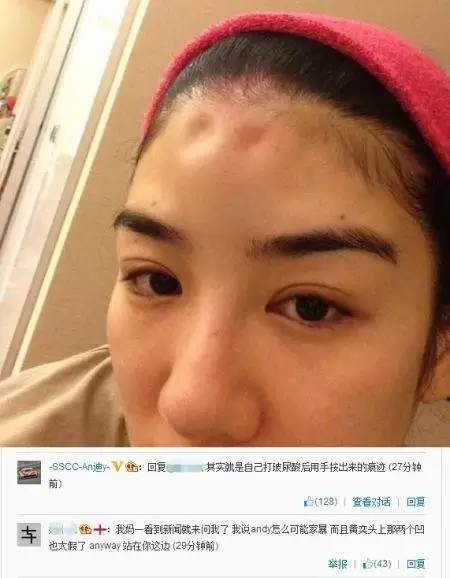 这对娱乐圈最狗血的离婚夫妻,把整容现场和家