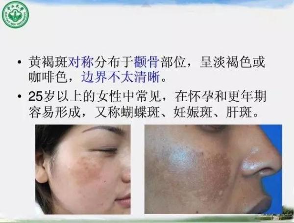 【涨知识】快收藏!中山大学老师教护肤的PPT