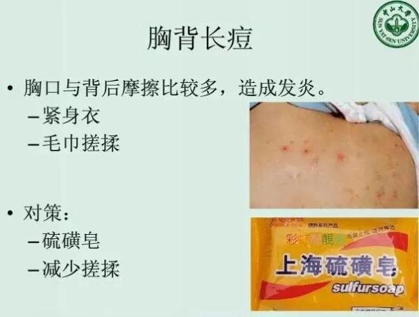 【涨知识】快收藏!中山大学老师教护肤的PPT