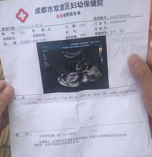 她6月做了引产和清宫手术 7月胎儿在肚子里"复生"了