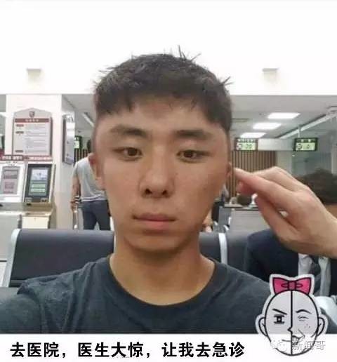 小伙染头发过敏差点毁容!自拍记录全过程,大家