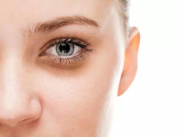 【护肤美体】三种类型黑眼圈,找准原因才能解