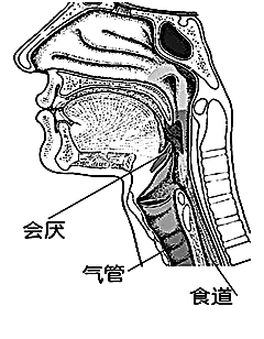 当心致命的急性会厌炎