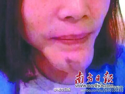 华体会体育官方网站（HTH Sports）大学生疑被套路花近14万元买美容品险“毁容”企业称是销售个人行为