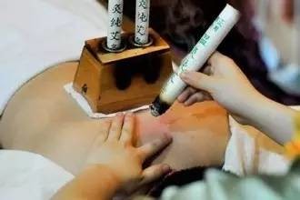 自己怎么给自己艾灸 3256434288449925195.jpg